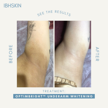 OptimBright™ Underarms Whitening