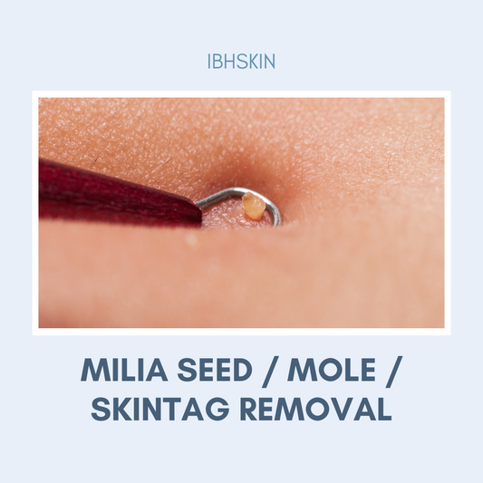 Milia Seed/ Mole/ Skintag Removal
